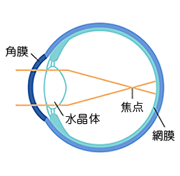 オルソケラトロジーレンズ装用前(近視の状態)の角膜の状態の図
