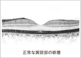 正常な黄斑部の断層のOCT画像